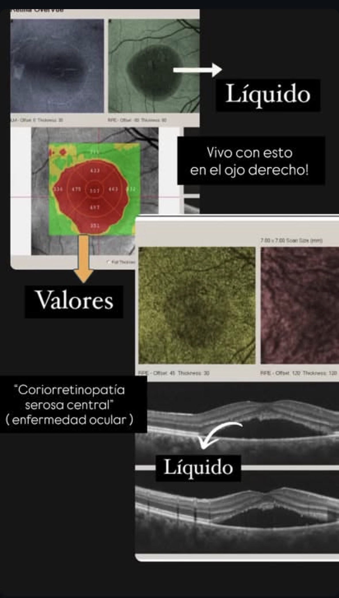 Rifa solidaria