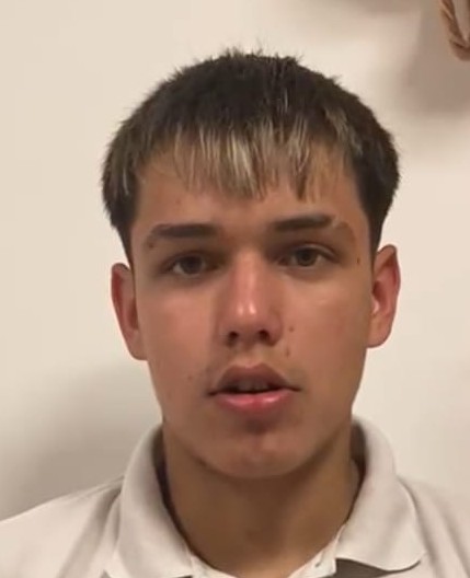 Alexander tiene 17 años y necesita urgente 3 prótesis!
