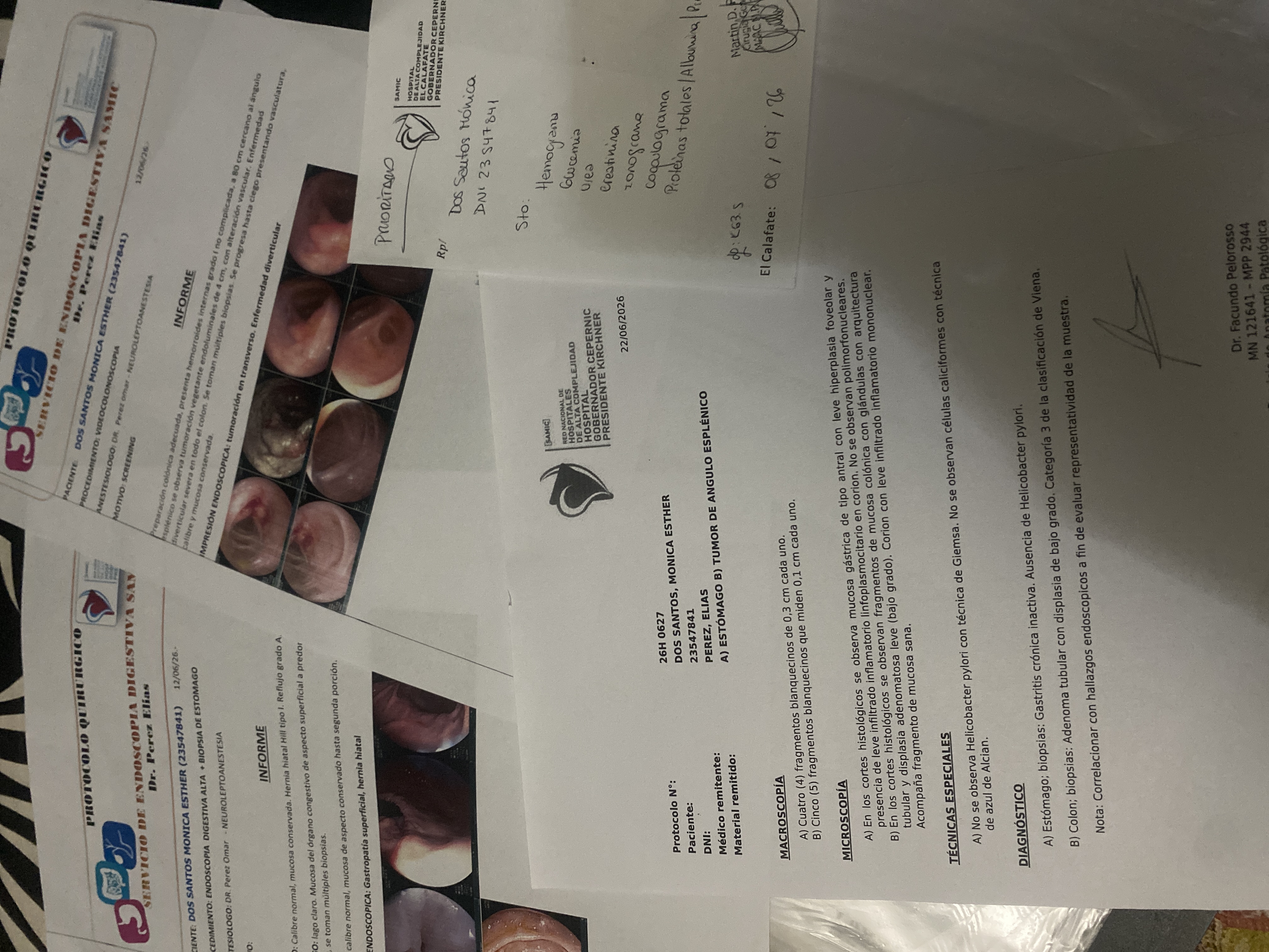 Rifa Solidaria para Cirugía y Recuperación